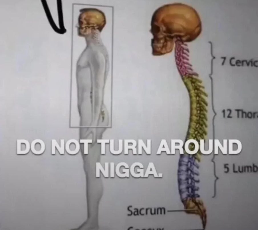 Do not turn around nigga Мем с изображением позвоночника и надписью "Do not turn around nigga"