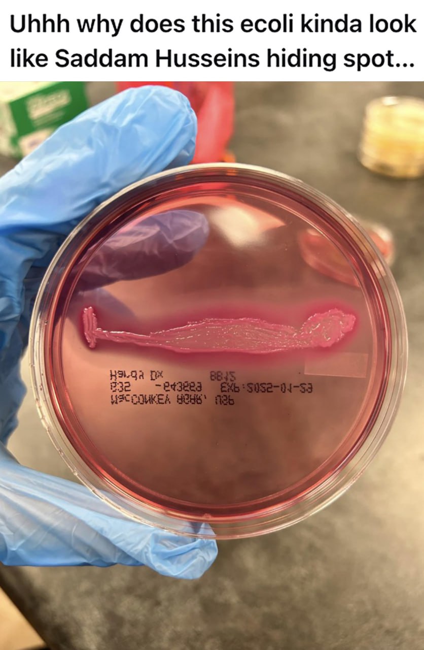 Ecoli похожа на укрытие Саддама Хусейна Культура кишечной палочки в чашке Петри, которая выглядит как укрытие Саддама Хусейна