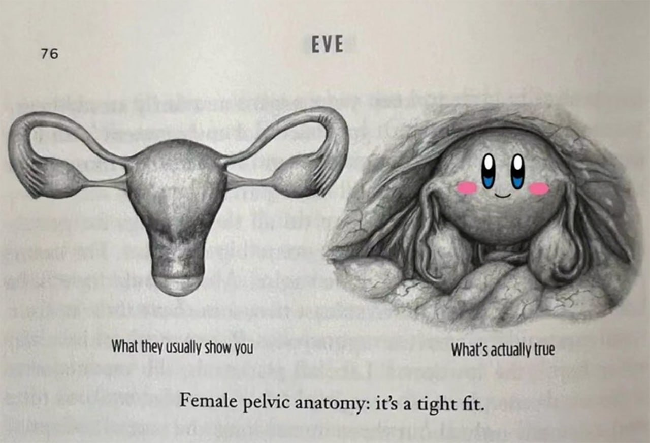 Female pelvic anatomy: it's a tight fit Мем с изображением анатомии женского таза, где внутри показан милый Кирби