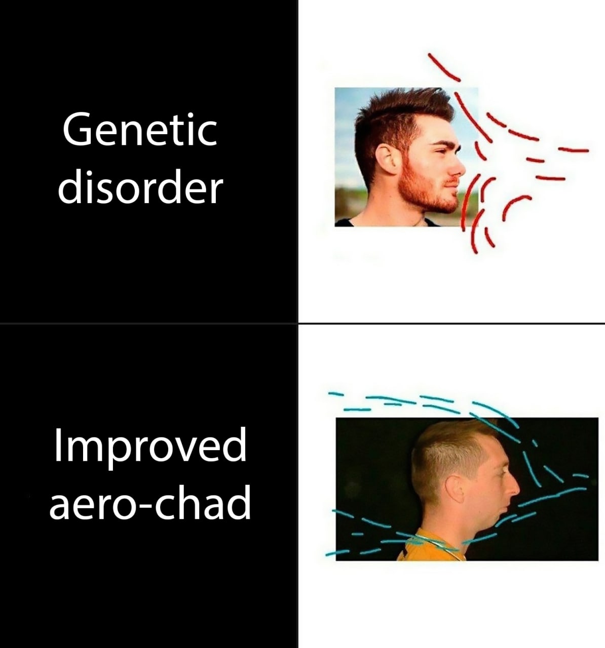 Genetic disorder Improved aero-chad Мем про генетическое расстройство и улучшенного аэро-чада, демонстрирующий два типа профиля лица с подписями.