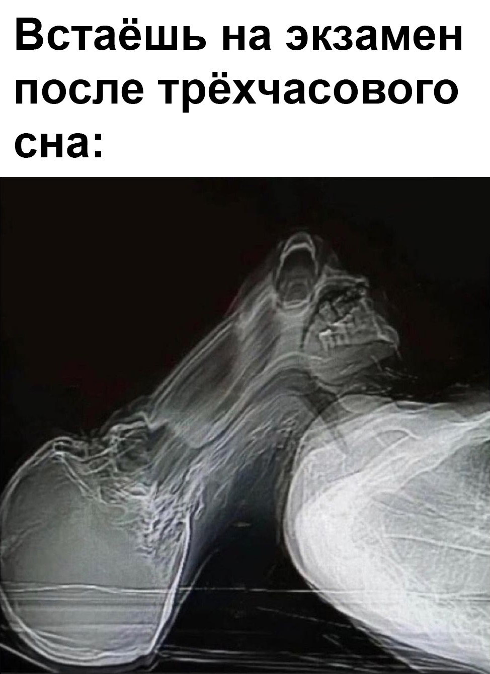 Встаёшь на экзамен после трёхчасового сна Рентгеновский снимок человека, который встаёт на экзамен после трёхчасового сна