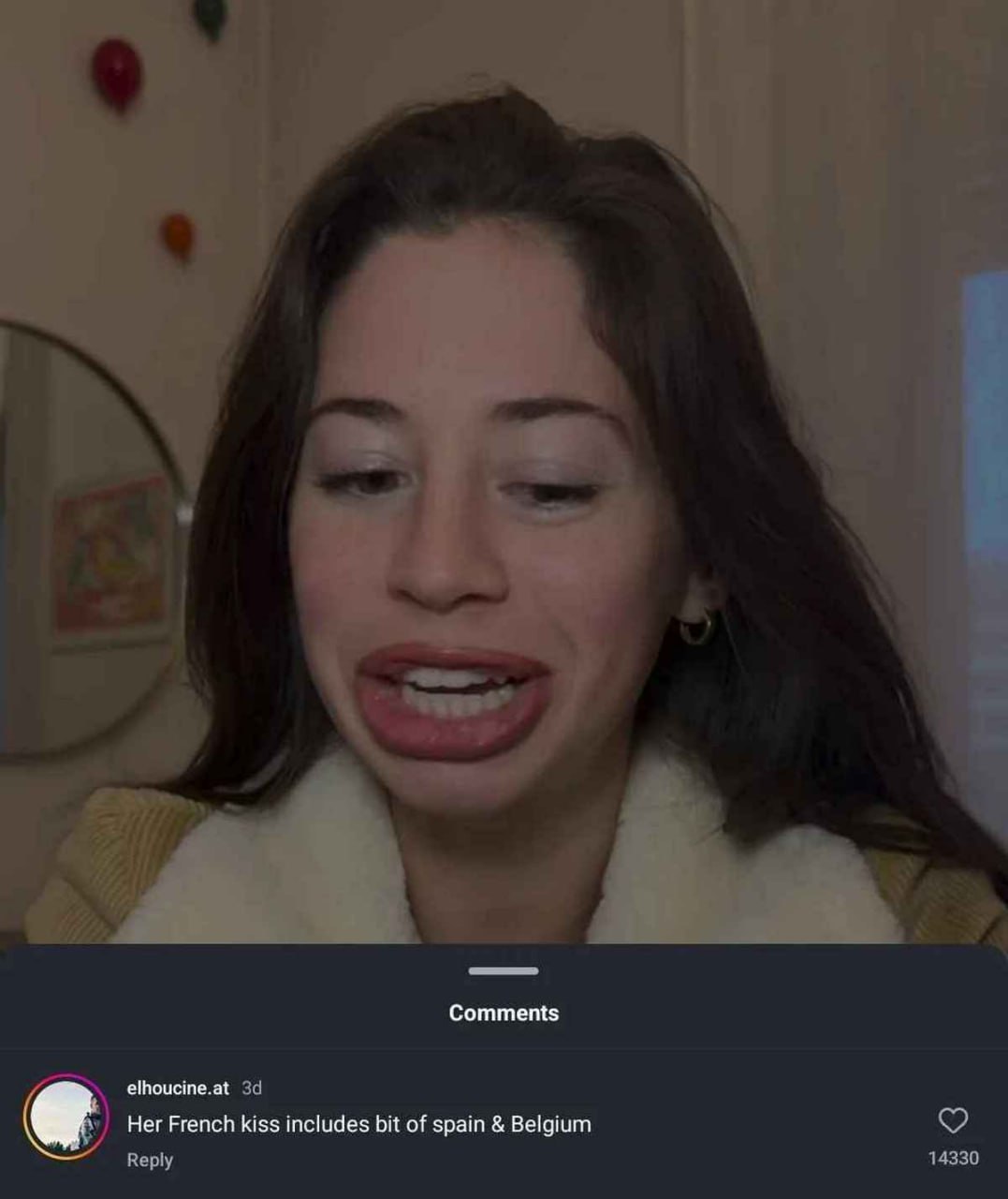 Her French kiss includes bit of spain & Belgium Девушка с сильно увеличенными губами и комментарий "Her French kiss includes bit of spain & Belgium"