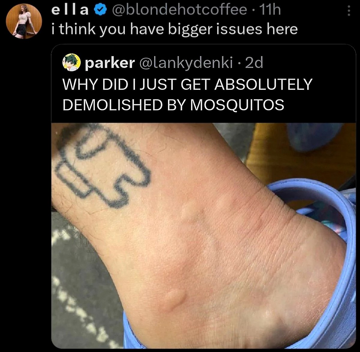 I think you have bigger issues here Укус комаров и татуировка Among Us на лодыжке