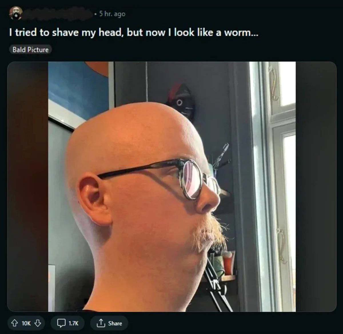 I tried to shave my head, but now I look like a worm Мужчина побрил голову и теперь похож на червяка