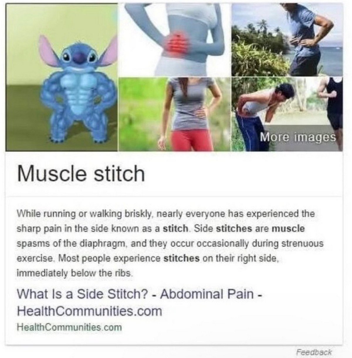 Мышечный Ститч Google поисковая выдача на запрос "Muscle stitch" со Ститчем-качком на главной картинке, в то время как остальные картинки иллюстрируют боль в боку (колики), которая по-английски тоже "stitch".