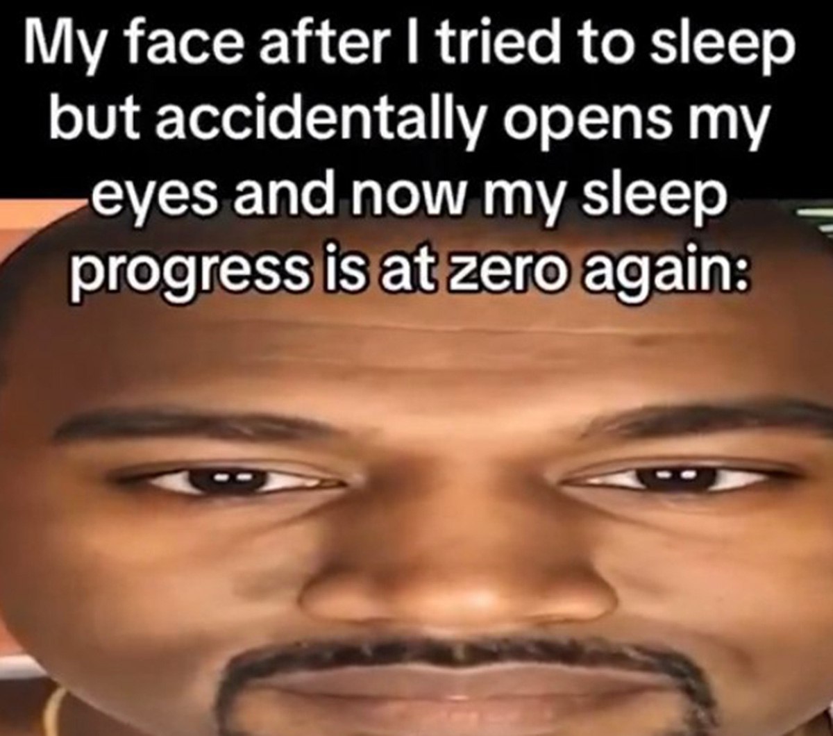 My face after I tried to sleep but accidentally opens my eyes and now my sleep progress is at zero again Мое лицо после того, как я попытался заснуть, но случайно открыл глаза, и теперь мой прогресс сна снова равен нулю