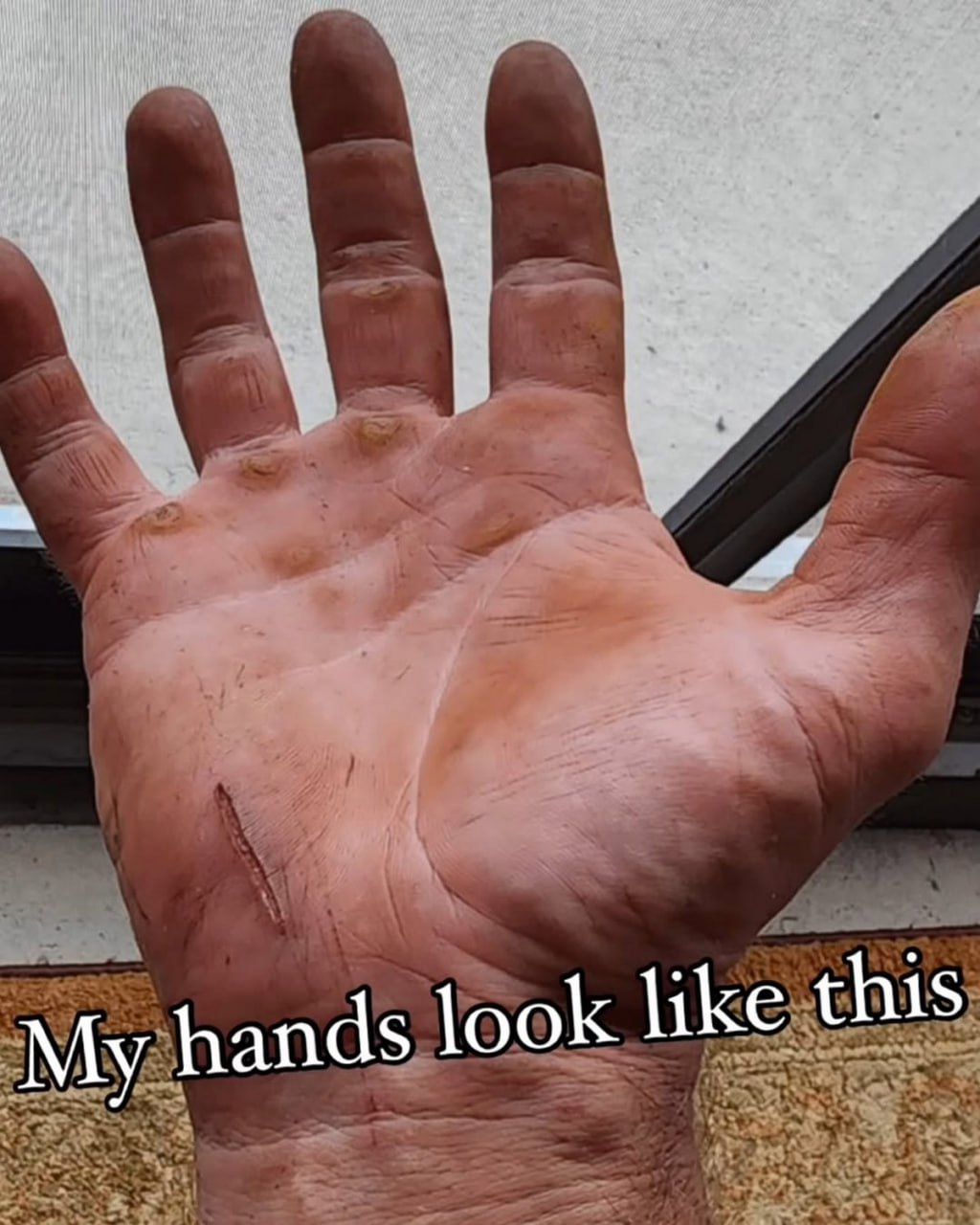 My hands look like this Грязная и мозолистая рука с порезом, надпись "My hands look like this"