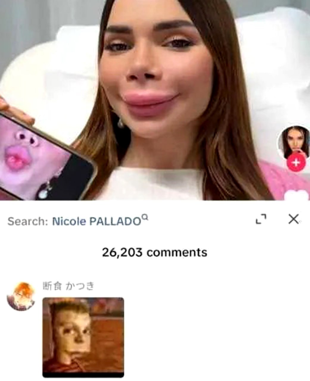 Nicole Pallado Женщина с огромными губами держит телефон, на котором ещё одни большие губы, а в комментариях картинка с Гомером Симпсоном