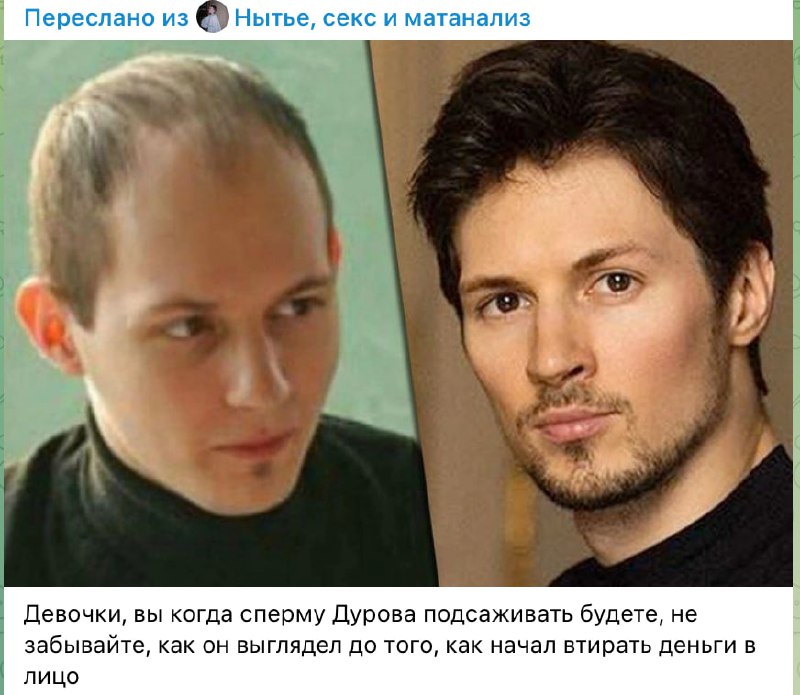 Мем про Павла Дурова до и после денег с надписью: Девочки, вы когда сперму Дурова подсаживать будете, не забывайте, как он выглядел до того, как начал втирать деньги в лицо