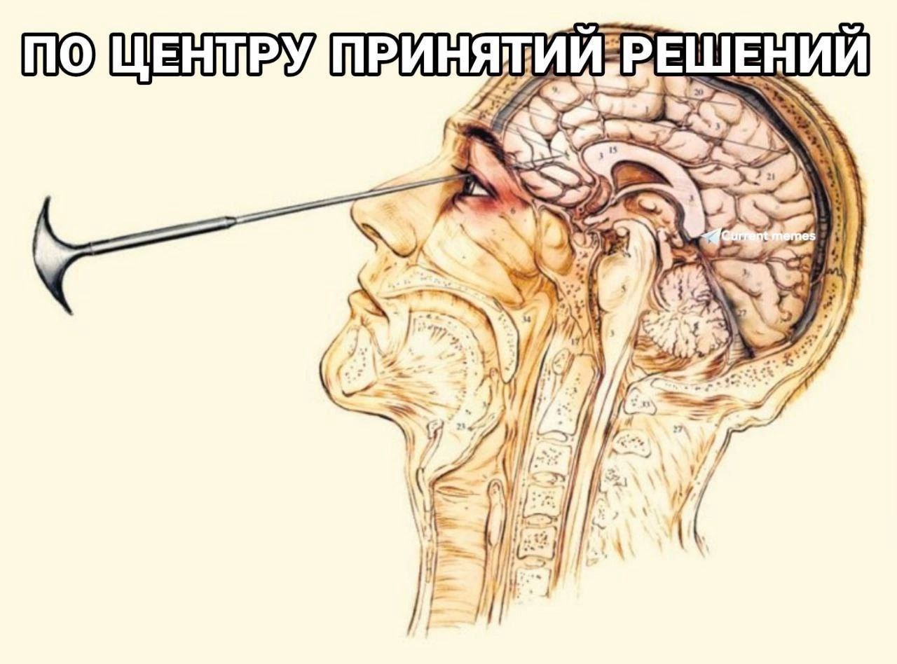 По центру принятий решений Лоботомия: по центру принятий решений