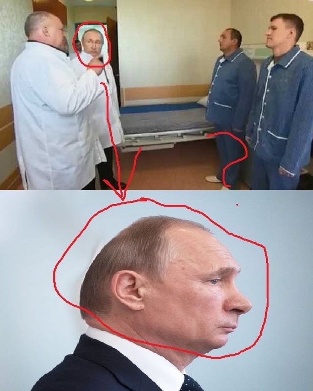 Путин на голове у врача Путин на голове у врача