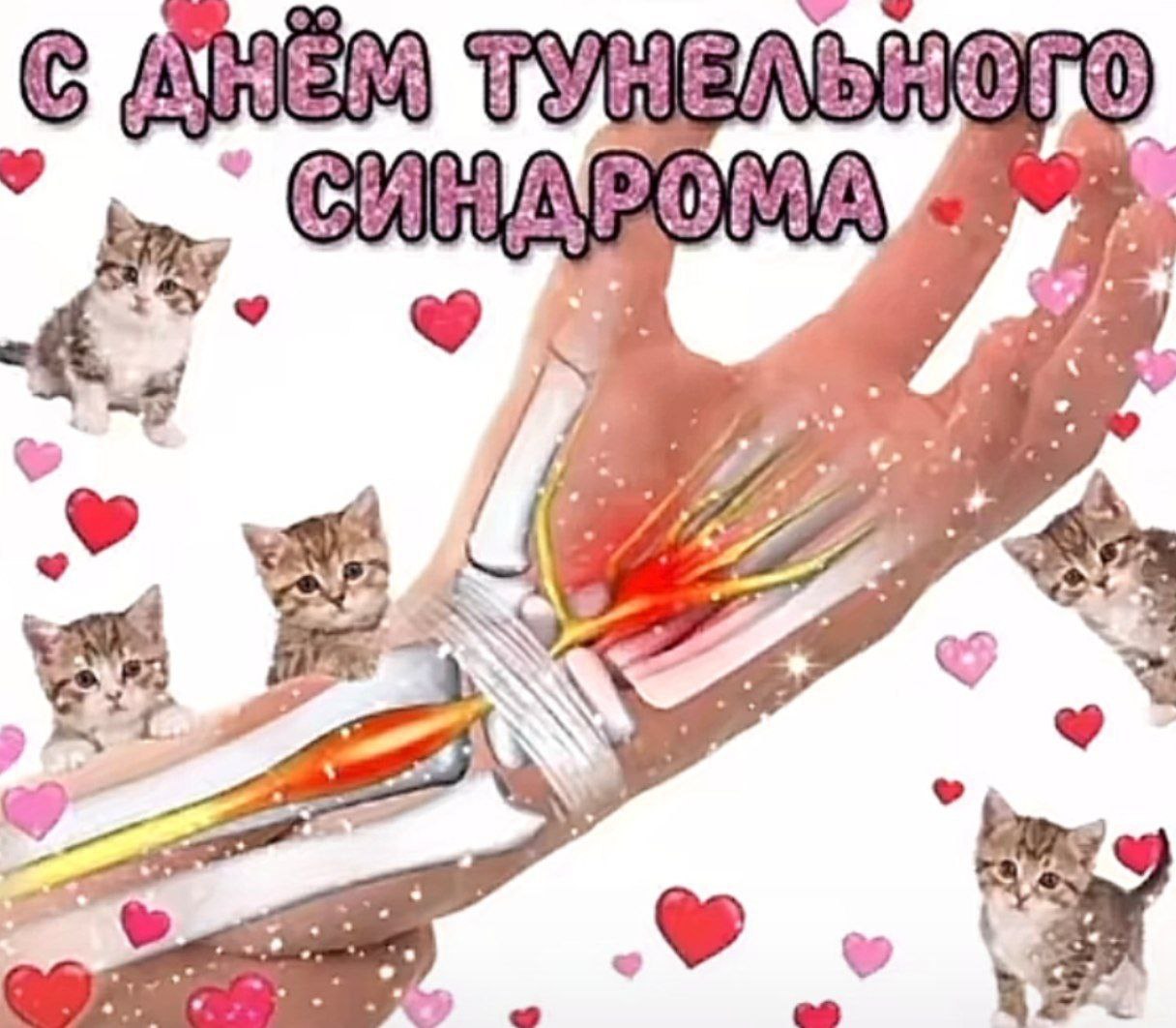 Мем с надписью «С днём туннельного синдрома» и котятами на фоне воспаленного запястья