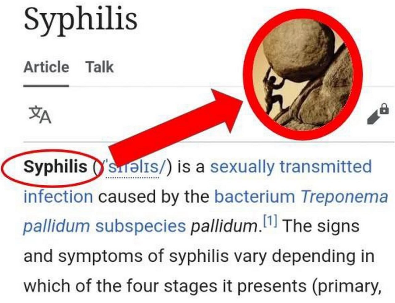 Сизиф и сифилис Мем, где красная стрелка указывает от слова "Syphilis" на иллюстрацию с Сизифом