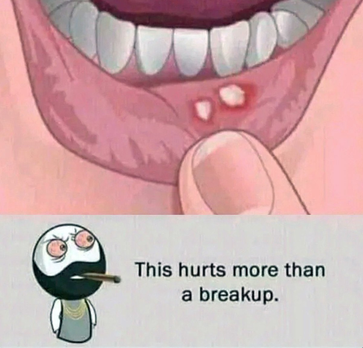 Hurts more than a breakup Язва на губе Hurts more than a breakup