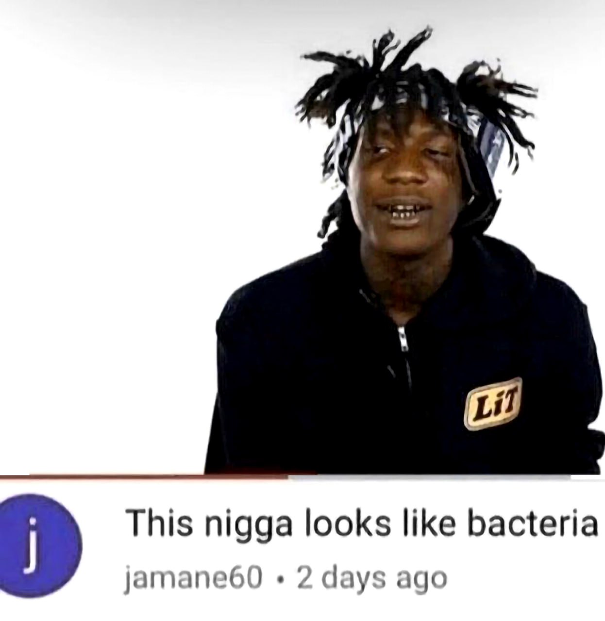 This nigga looks like bacteria Мужчина с дредами и золотыми грилзами на зубах на белом фоне, а внизу виден комментарий на ютубе, в котором написано: «This nigga looks like bacteria».