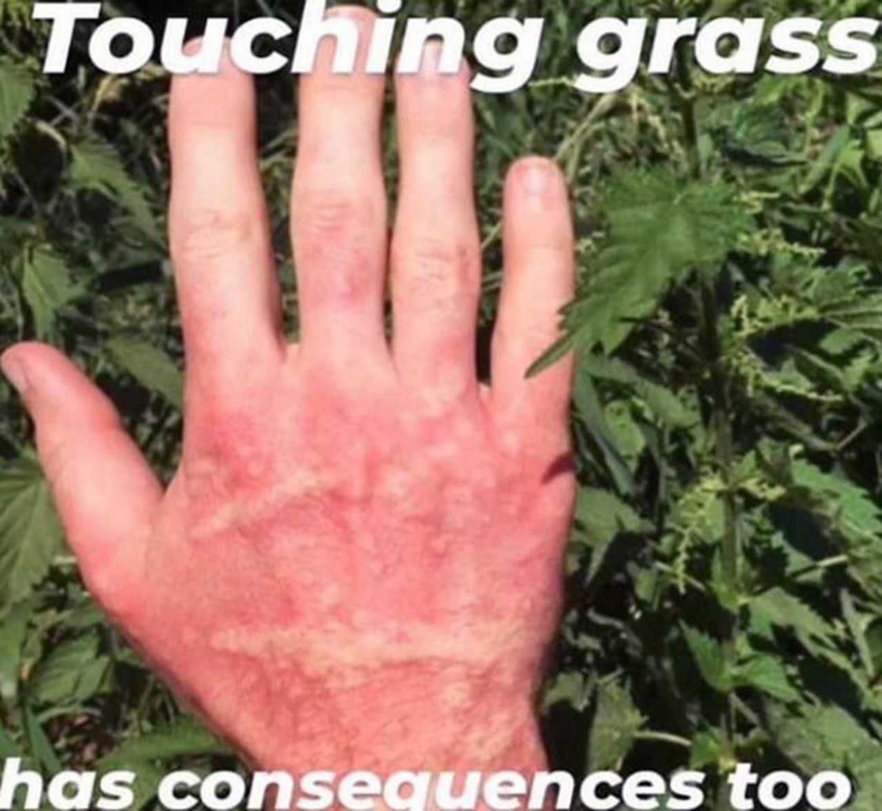Touching grass has consequences too Раскрасневшаяся рука, видимо, от прикосновения к крапиве, на фоне зеленых зарослей.
