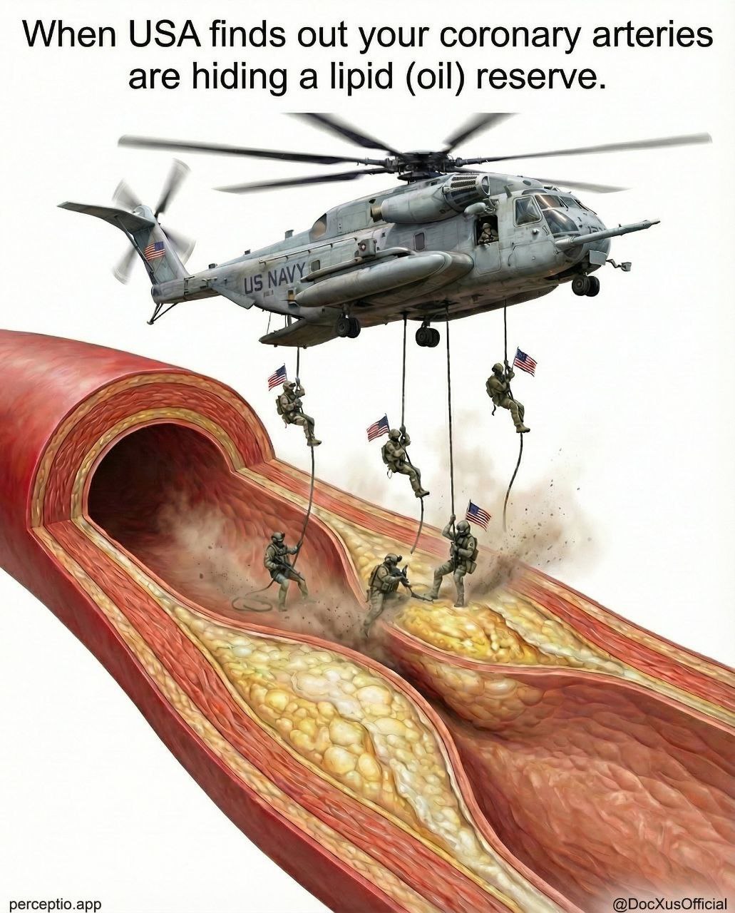 Когда США узнают, что в твоих коронарных артериях есть запасы липидов (нефти)