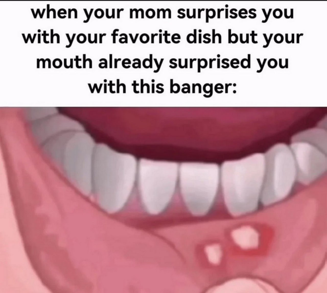 When your mom surprises you with your favorite dish but your mouth already surprised you with this banger Мем про язвочки во рту и любимое блюдо мамы